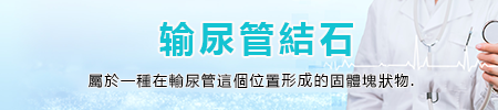 输尿管结石